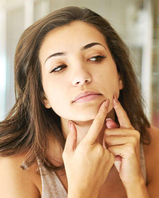 Acne prone skin treatment