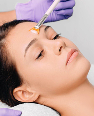 Glycolic Peel Treatment in Chandigarh at Panache Skin Clinic