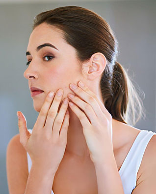 Pimple Treatment in Chandigarh – Advanced Solutions for Clear & Healthy Skin