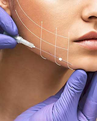 Thread Lift in Chandigarh